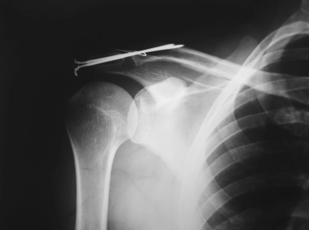 <br>Fig. 2.