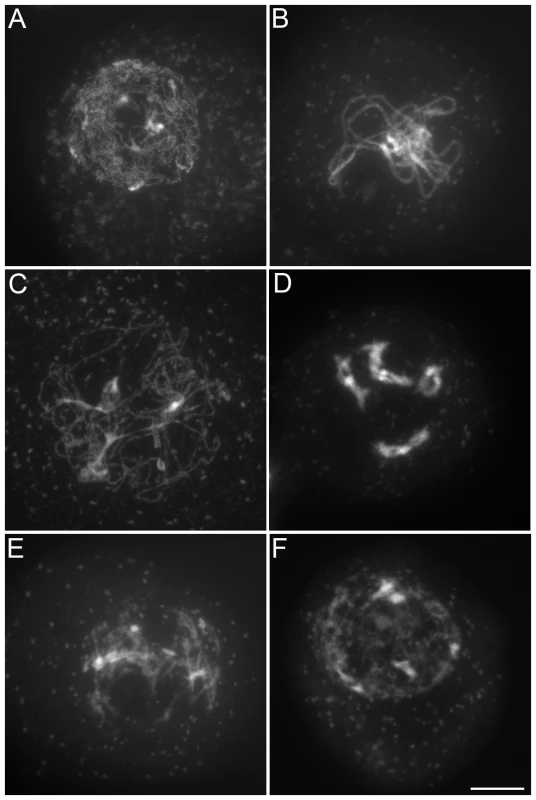 Male meiosis in <i>tam-2/osd1-1</i>.