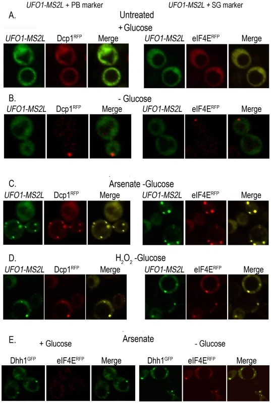 <i>UFO1-MS2L</i> mRNAs induced by stress colocalize with subunits of PBs and SGs.