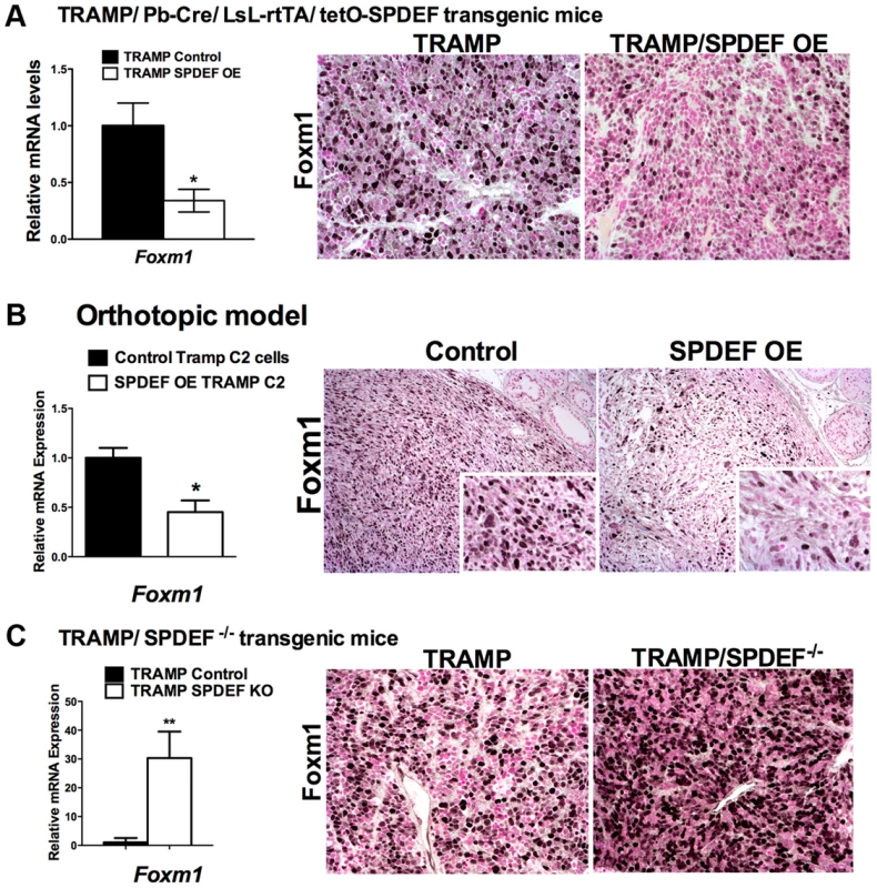 SPDEF and Foxm1 are inversely correlated in prostate carcinogenesis.