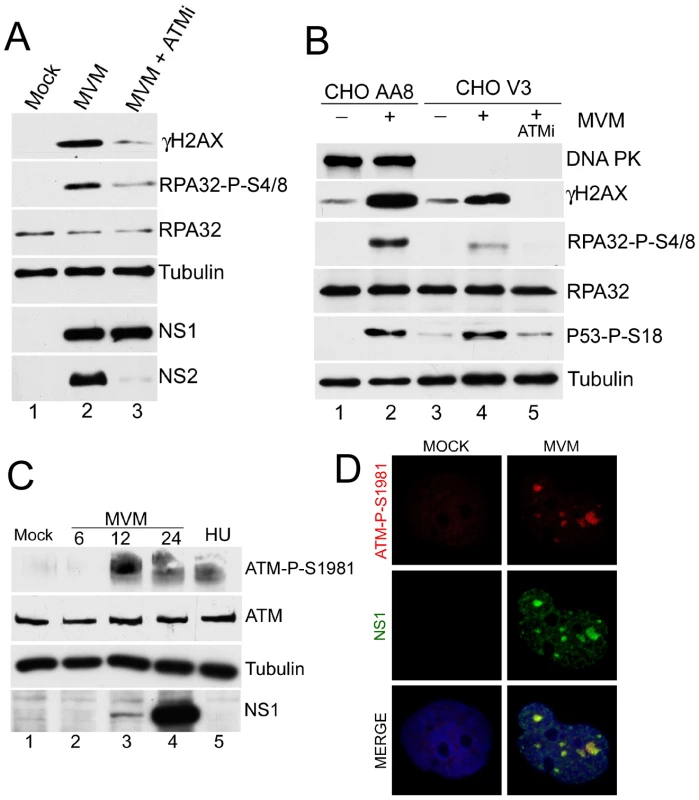 Activated ATM is predominantly responsible for signaling events during MVM infection.
