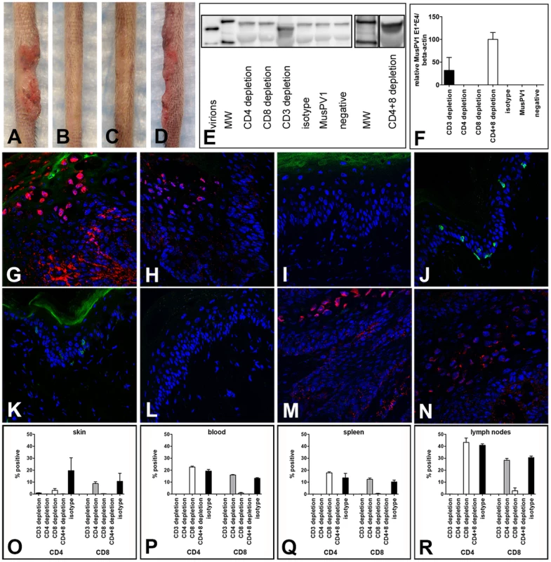 CD3<sup>+</sup>, but not single CD4<sup>+</sup> or single CD8<sup>+</sup> T cell depletion allows papilloma formation in C57BL/6 mice.