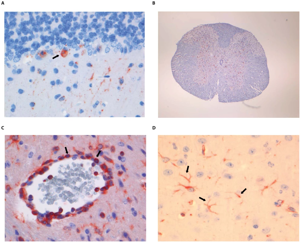 Histopathology of 8-week old BALB/c mice infected i.m. with 10<sup>6</sup> TCID<sub>50</sub> of RABV-PV.