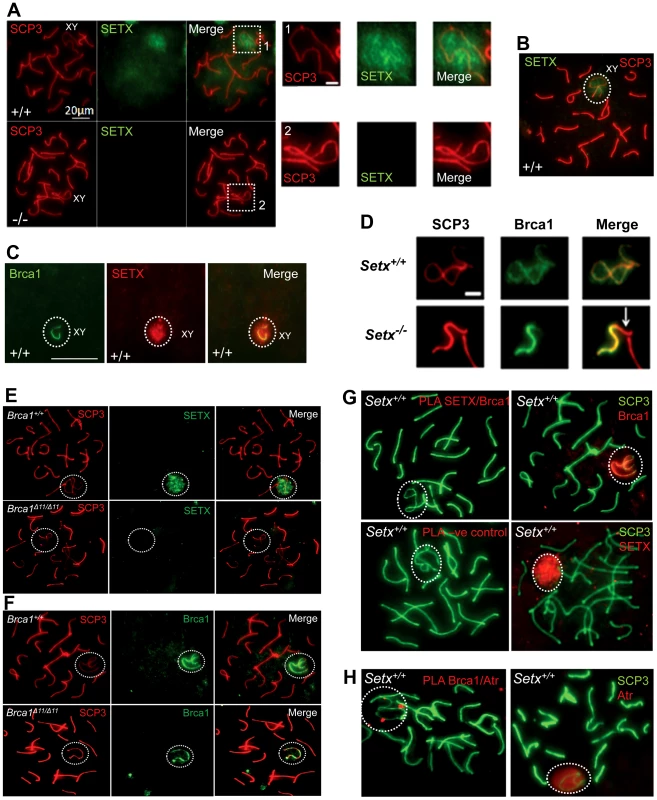 Senataxin localises to the sex chromosomes during meiosis.