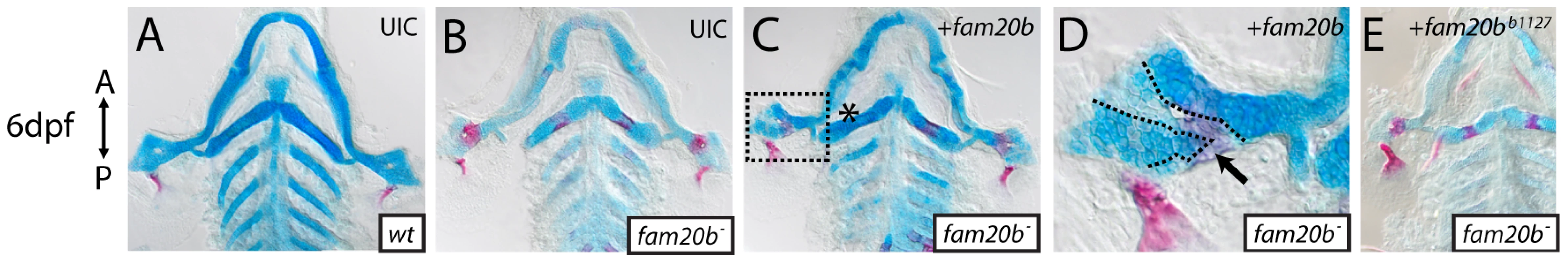 Wild-type <i>fam20b</i> expression rescues the <i>fam20b<sup>b1127</sup></i> mutant phenotype.