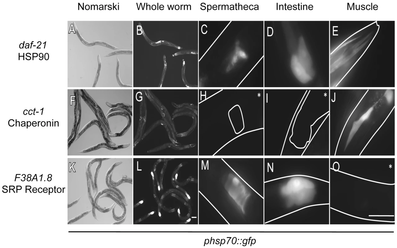 Tissue-selective induction of the <b><i>phsp70::gfp</i></b><b> reporter by knockdown of negative regulators.</b>