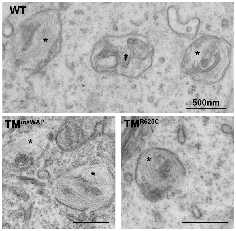 PMEL TMD mutants can form fibrils when overexpressed in non-pigmented cells.