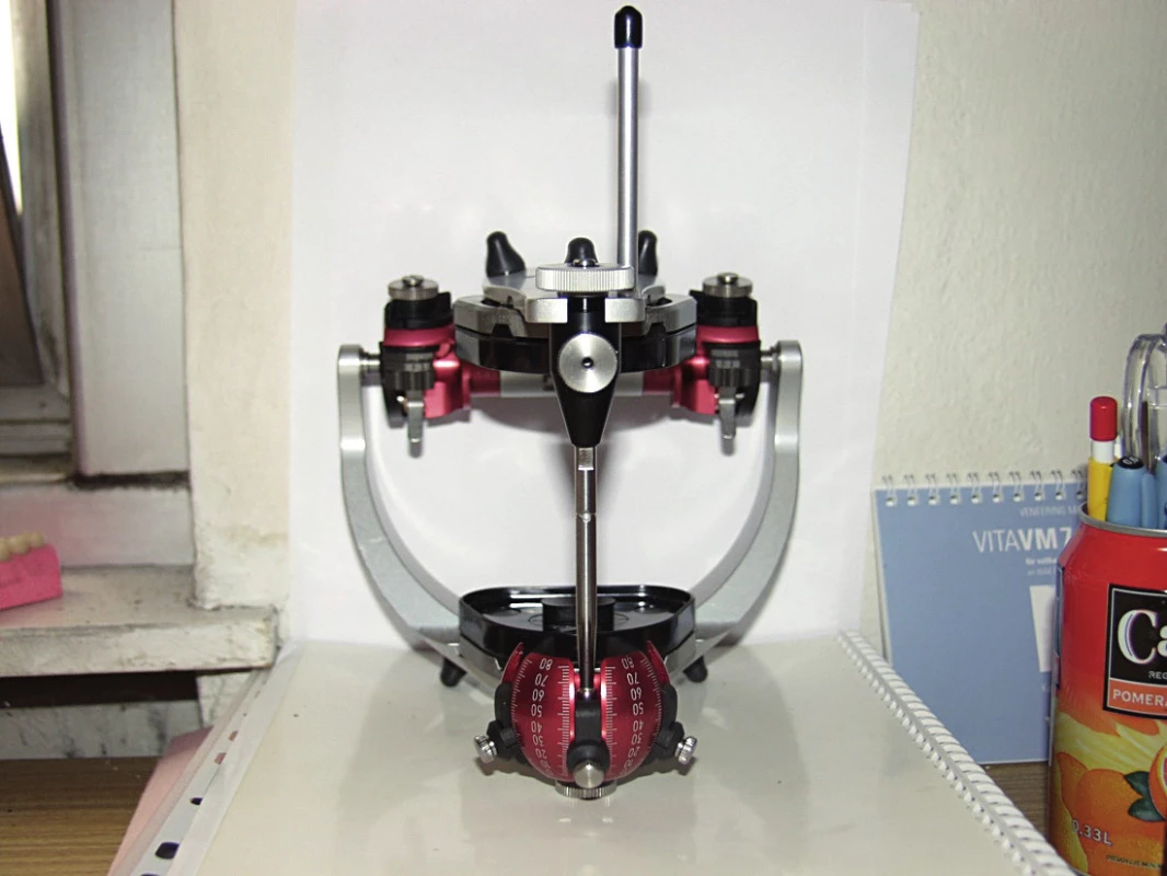 Individuálně programovatelný artikulátor Protar Evo 7 (foto autoři)