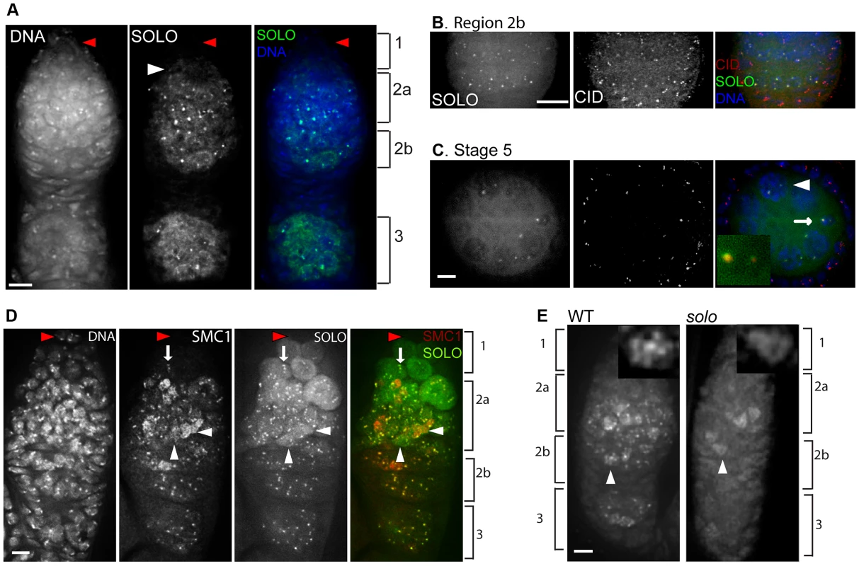 SOLO and SMC1 are enriched at centromeres and interact genetically.