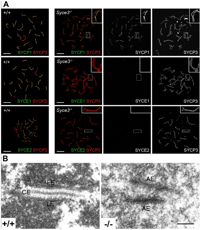 Initiation of synapsis is dependent on SYCE3.