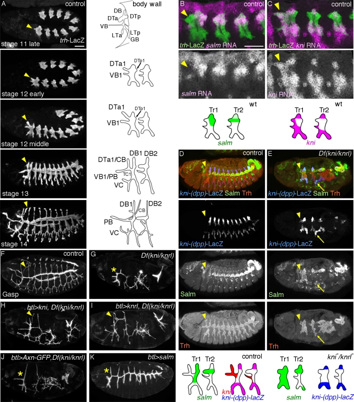 Developmental and genetic distinction between DTa1 and the rest of DT.
