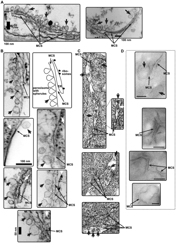 The presence of MCS-like structures in the vicinity of tombusvirus-induced spherules in plant cells infected with CNV or in yeast cells replicating TBSV repRNA.