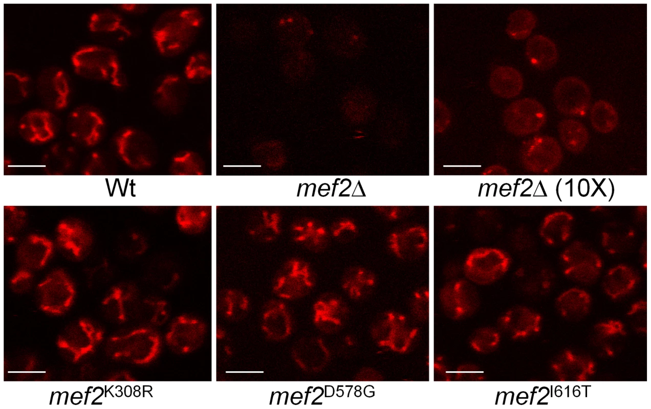 Visualisation of mitochondrial membrane potential.