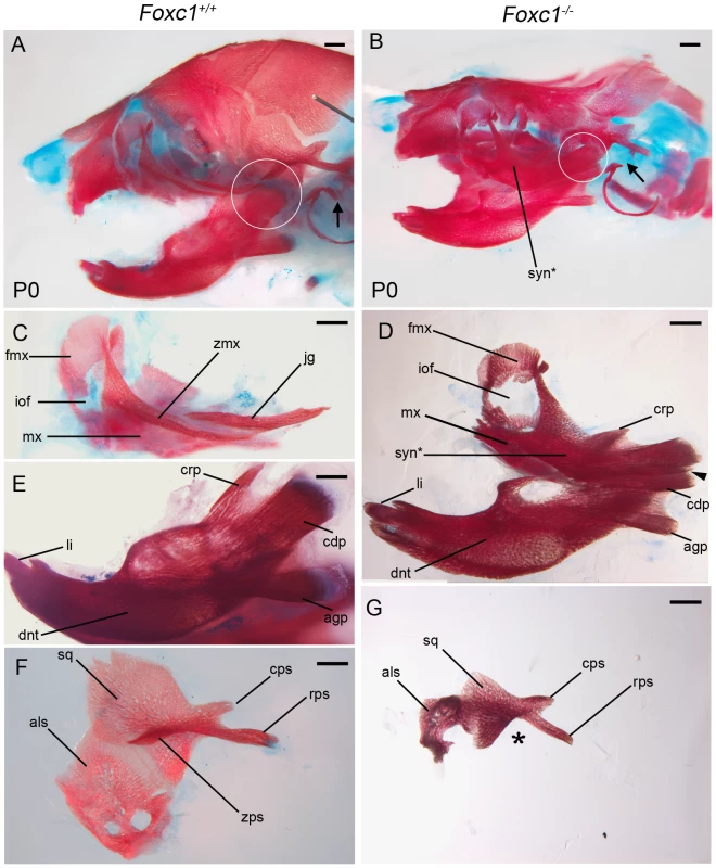 Foxc1<sup>−/−</sup> neonates exhibit syngnathia and TMJ agenesis.