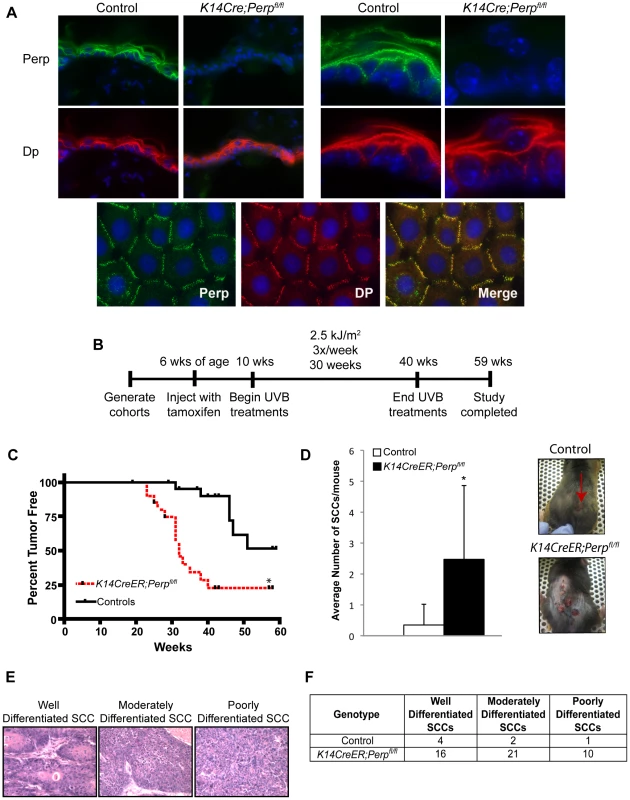 <i>Perp</i>-deficiency promotes tumorigenesis.