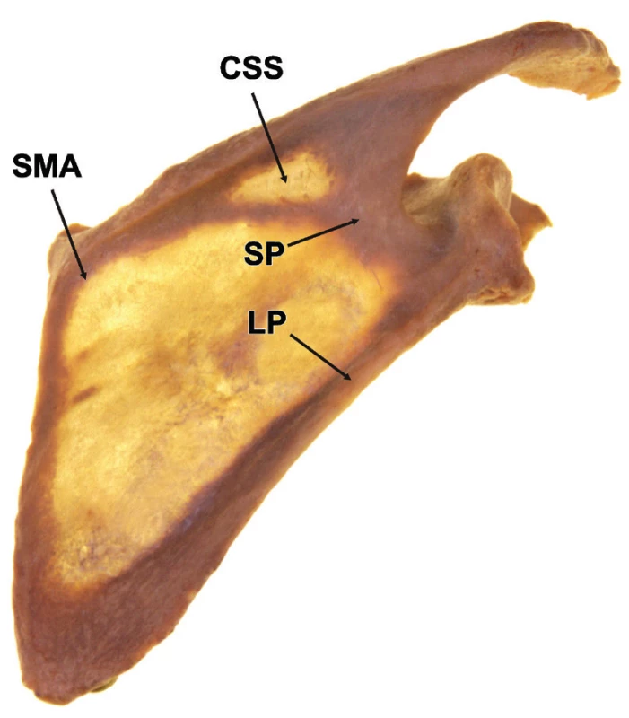 Vnitřní architektura lopatky SMA – spinomediální úhel, SP – spinózní pilíř, LP – laterální pilíř, CSS – centrální zeslabení spina scapulae
Fig. 1: Internal architecture of scapula SMA – spinomedial angle, SP – spinous pillar, LP – lateral pillar, CSS – central weakening of scapular spine