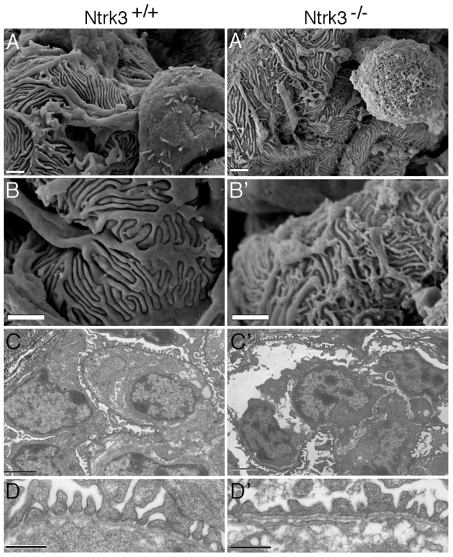 Ultrastructural Analysis of <i>Ntrk3</i> Mutant Kidneys.