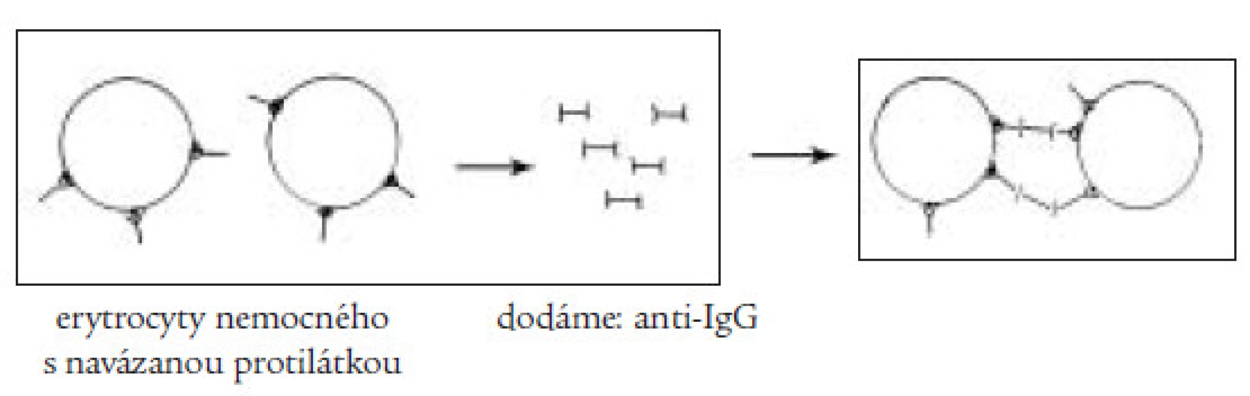 Přímý Coombsův test slouží k průkazu protilátek vázaných na erytrocyt, při dodání antiIgG-protilátky dochází k aglutinaci erytrocytů s navázanou protilátkou.