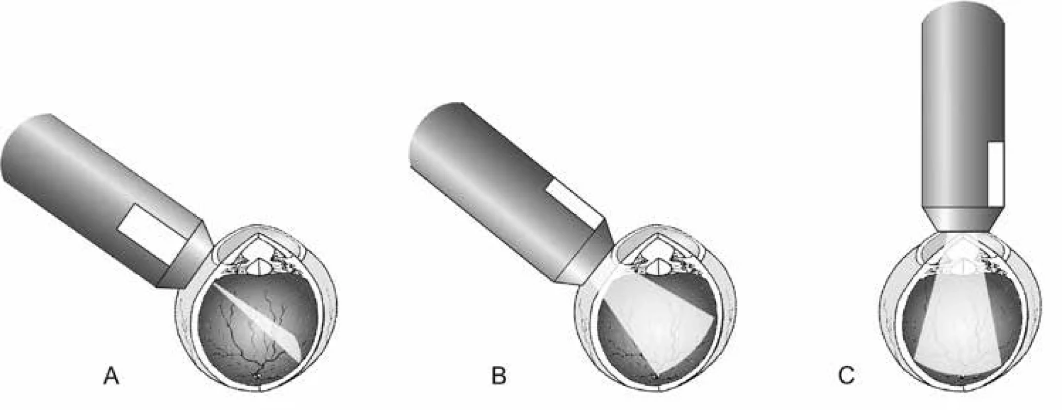 Základní polohy B-sondy při transokulárním zobrazení: (A) transverzální, (B) longitudinální, (C) axiální