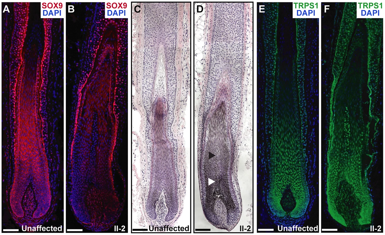 Expression and histological analyses of CGHT follicles.