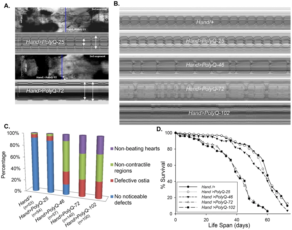 Cardiac defects are associated with expression of mutant Poly-Q.