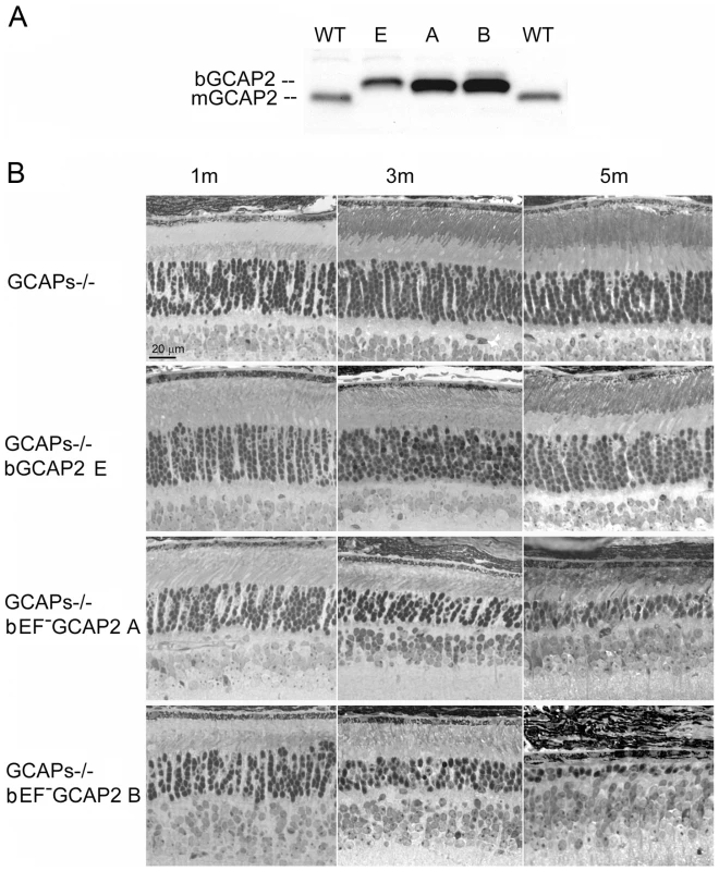 Transgenic expression and rate of retinal degeneration in the GCAPs−/− background.