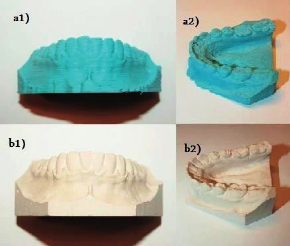 Srovnání a) tradičních sádrových modelů a b) modelů získaných 3D tiskem: frontální pohled a1) a b1) a pohled semi-okluzální a2) a b2)
