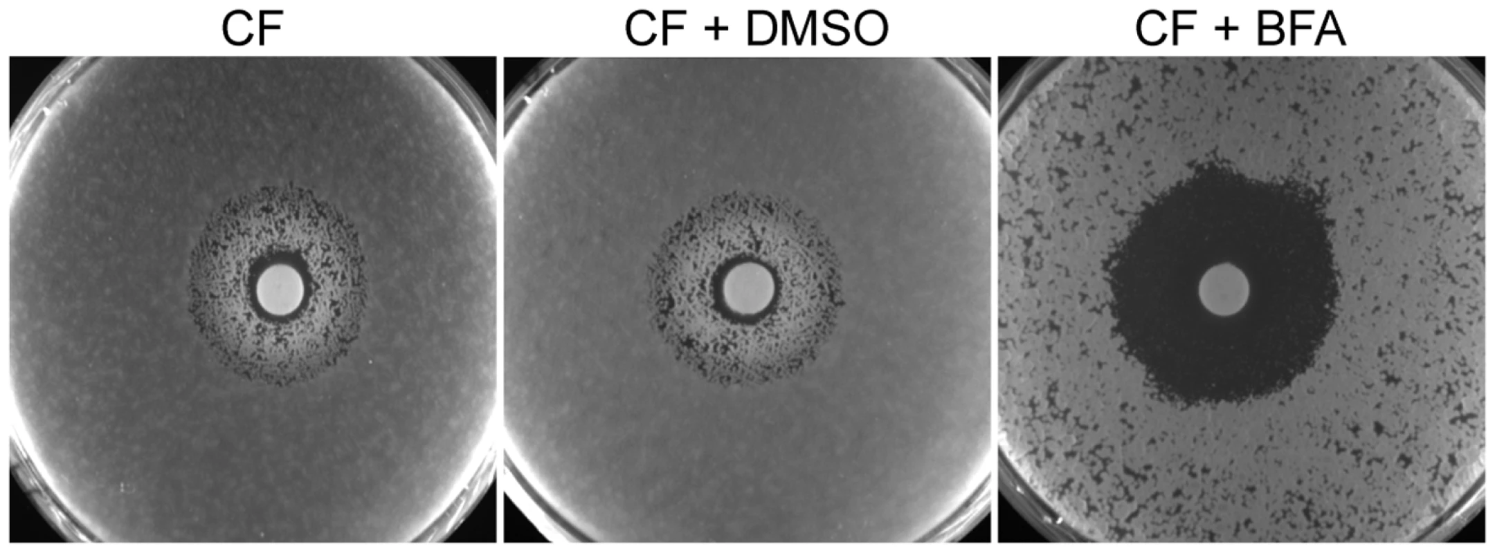 BFA synergism with the fungistatic cell wall inhibitor CF in <i>A. fumigatus</i>.