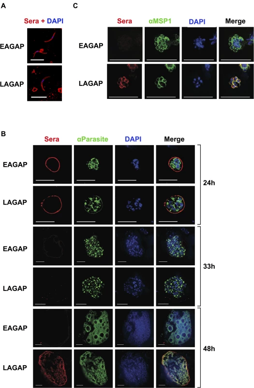 Antibodies elicited by a late liver stage-arresting but not early liver stage-arresting GAP recognize antigens of both late liver stages and blood stages.