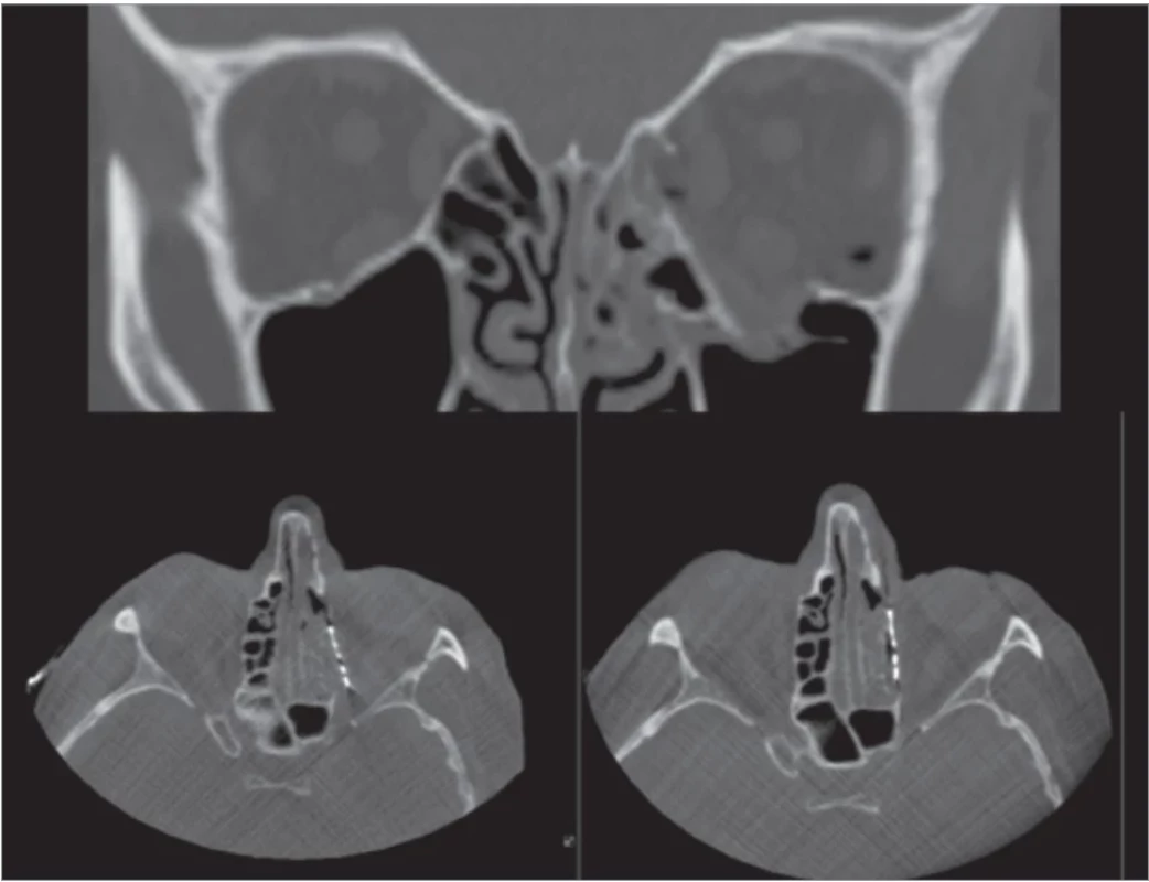 Top – severity of dislocation, left – inaccurate position, right – appropriate position.