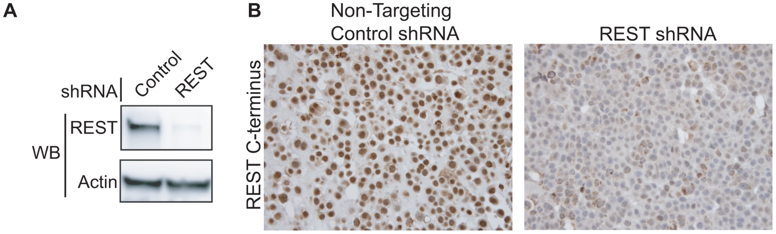 Testing the specificity of the REST C-terminal antibody.