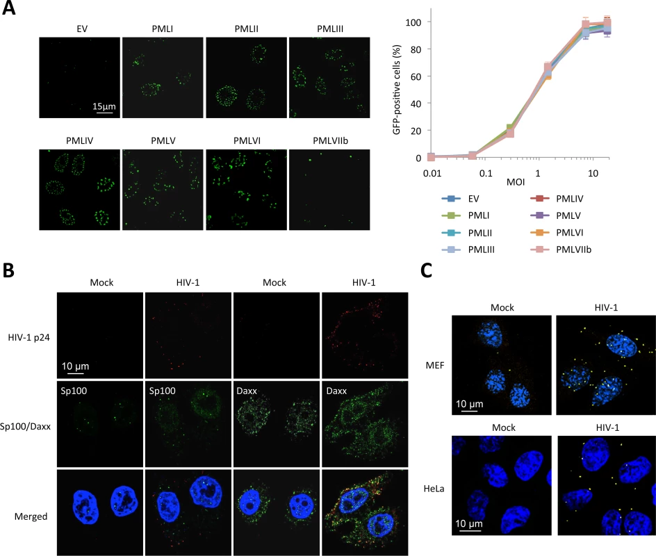 PML is not the main mediator of HIV-1 restriction.