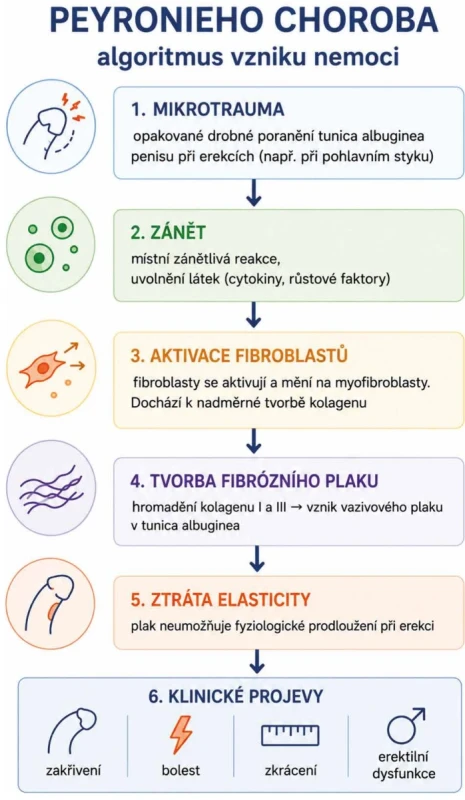 Patofyziologie Peyronieho choroby