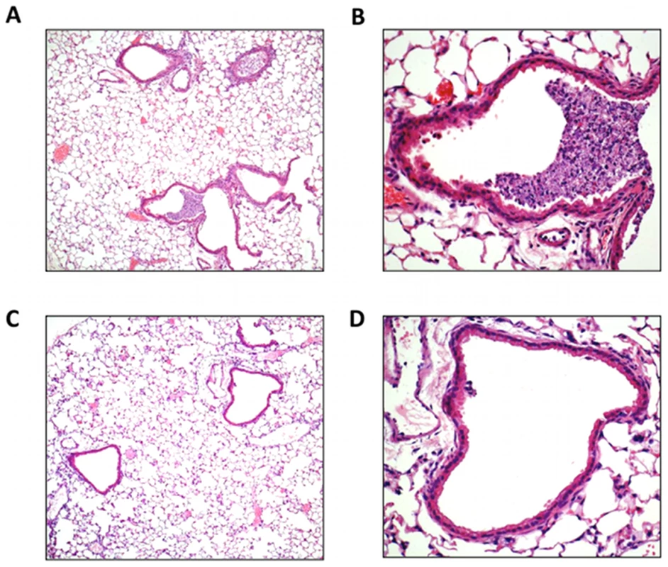 Lung histology in response to H3N2 (X-31) influenza A virus infection.