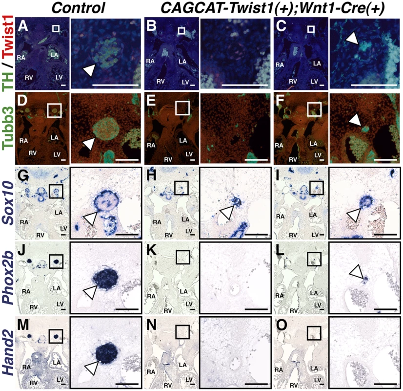 Sympathetic neurogenesis is disrupted by Twist1 mis-expression.