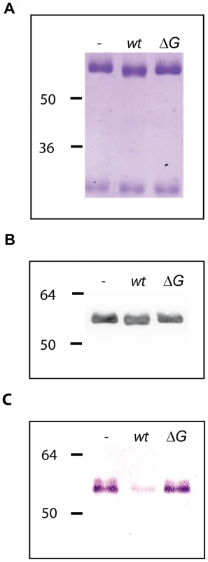 Human IgG deglycosylation.