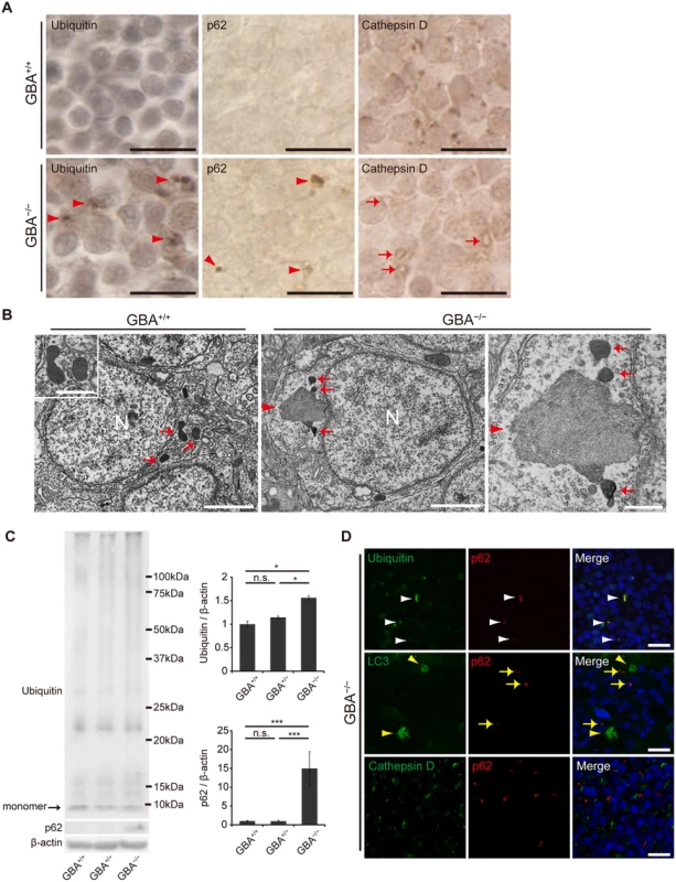 Impairment of the autophagy-lysosome pathway in <i>GBA</i><sup>-/-</sup> medaka.
