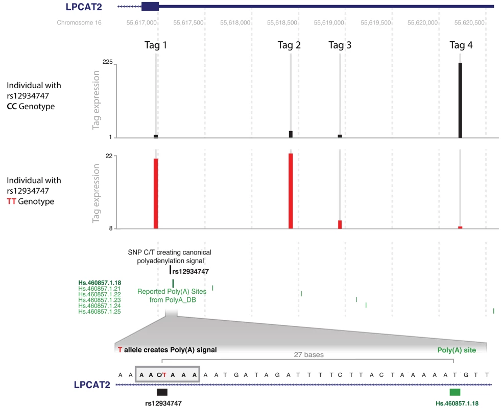 rs12934747*T creates a poly(A) signal in <i>LPCAT2</i> and leads to alternative polyadenylation site usage.