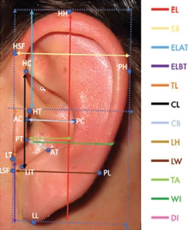 Fourteen orientation points and 13 measurements.