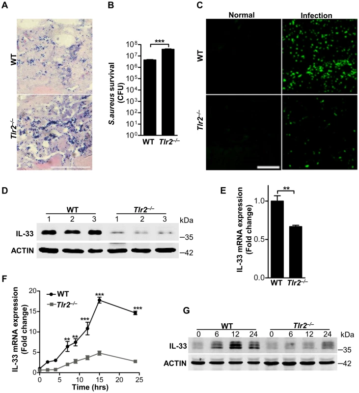TLR2 is required for <i>Staphylococcus aureus</i> to induce IL-33.