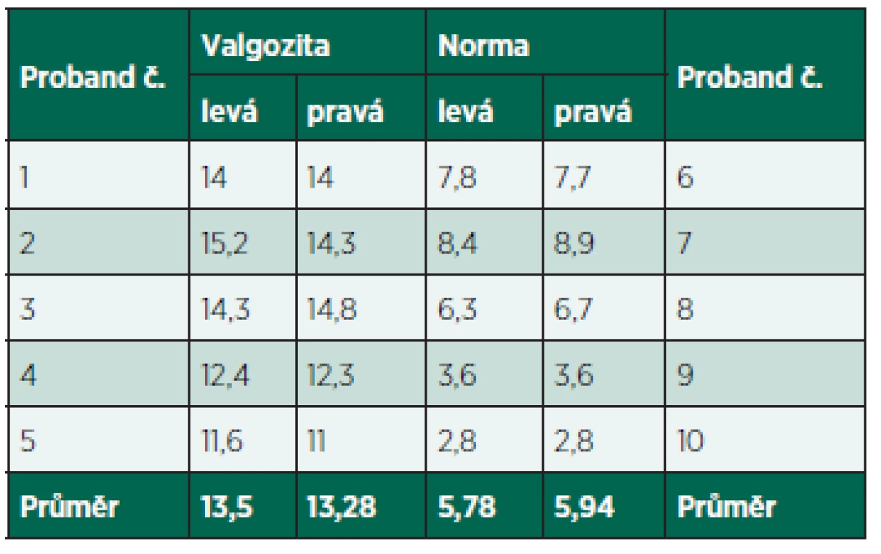 Hodnoty T-F úhlu každého probanda měřené pomocí metody Čulíka a Maříka (2002).