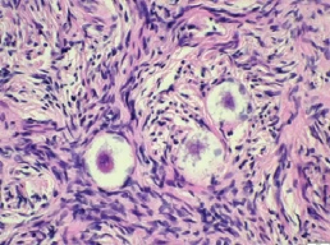 a. Histologický řez kortikální tkáně vaječníku před zamražením – primordiální folikl (barevní HE, 400×). Fig. 9a. Histological section of ovarian cortical tissue before cryopreservation – primordial follicle (HE staining, 400×). HE – hematoxylin a eozin