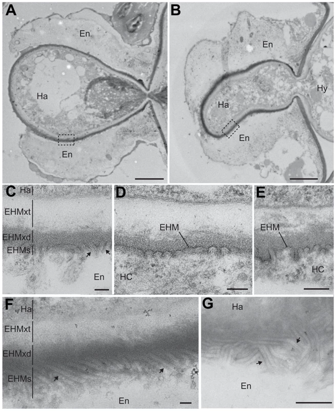 PDLP1 promotes membrane tubule formation at the extra-haustorial interface.