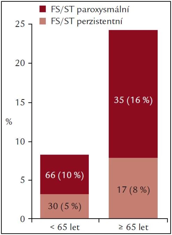 Zastoupení recidivující paroxysmální versus perzistentní arytmie – fibrilace síní (FS) nebo síňová tachykardie (ST). Podrobnosti jsou v textu.