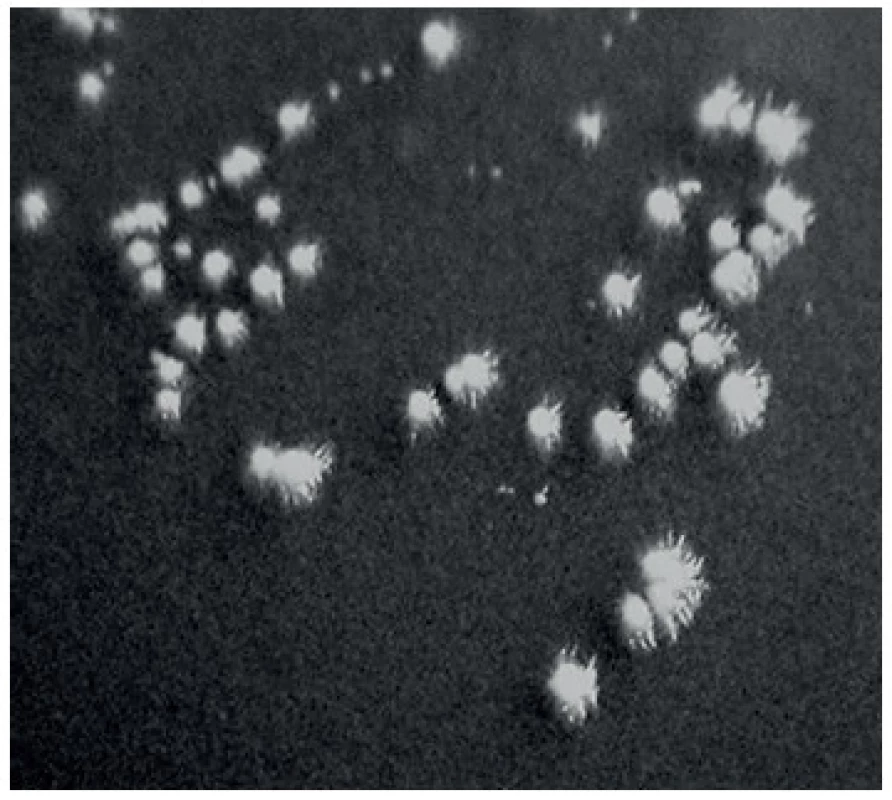 Vzhled kolonií C. dubliniensis na Staibově agaru
Fig 1. The apperarance of C. dubliniensis colonies on Staib medium