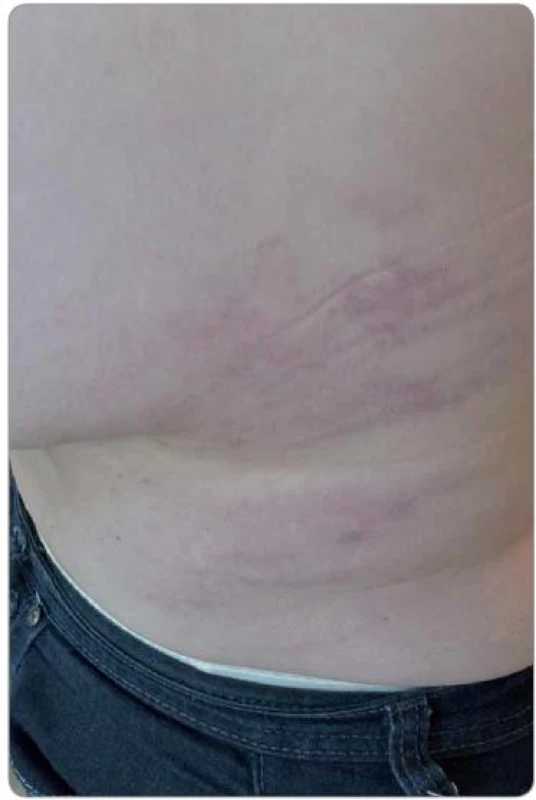 Klinický nález.