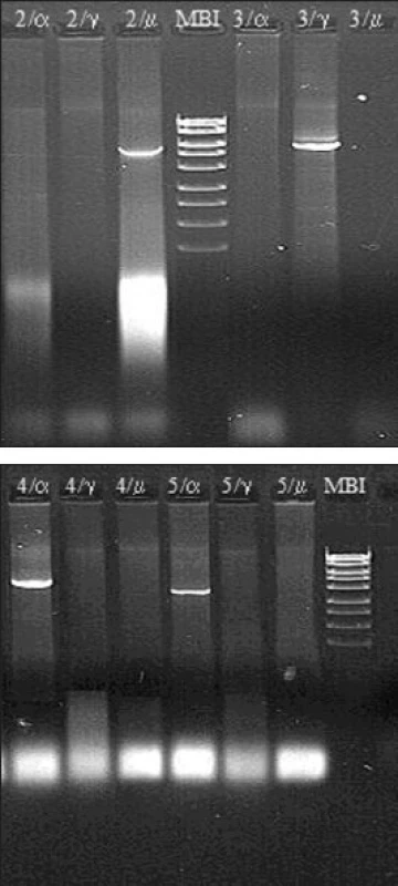 a. a b. Molekulárně biologická diagnostika Burkittova lymfomu – metoda long distance PCR (materiál Centra molekulární biologie a genové terapie Interní hematoonkologické kliniky, zpracovala A. Marečková). 
Metoda umožňuje detekovat nejčastější translokaci u Burkittova lymfomu t(8;14)(q24;q32). Diagnostika je založena na třech nezávislých PCR reakcích s jedním společným primerem navrženým do 2. exonu genu c-myc a třemi primery navrženými do konstantních oblastí Cα, Cμ a Cγ genu pro IgH.