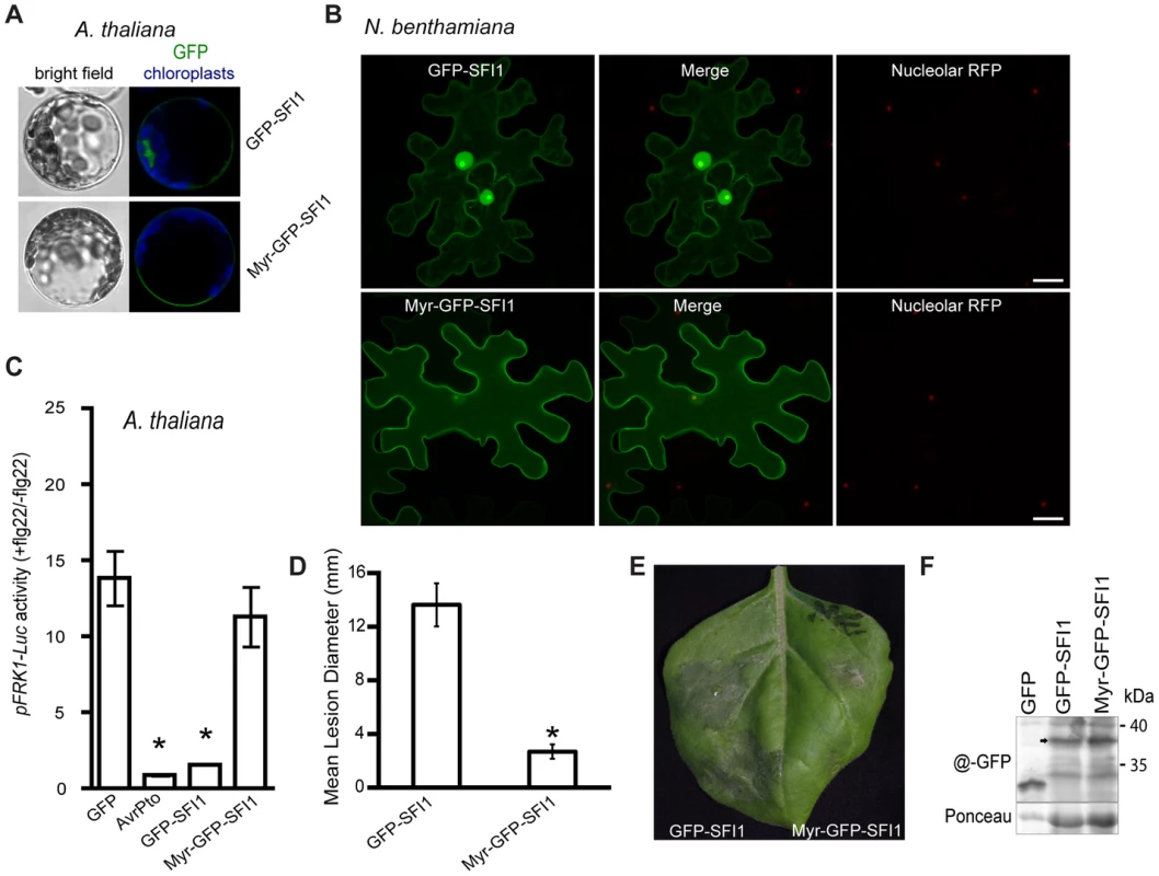 Importance of the nuclear localization of SFI1 for suppression of flg22-triggered <i>pFRK1-Luc</i> expression in <i>A. thaliana</i> and for <i>P. infestans</i> colonization in <i>N. benthamiana</i>.