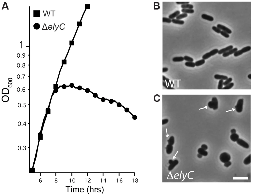 Loss of ElyC function results in lysis.