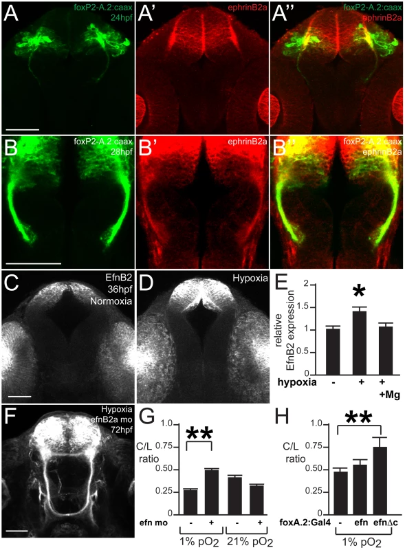 ephrinB2a mediates the hypoxia-induced TCPT pathfinding errors.